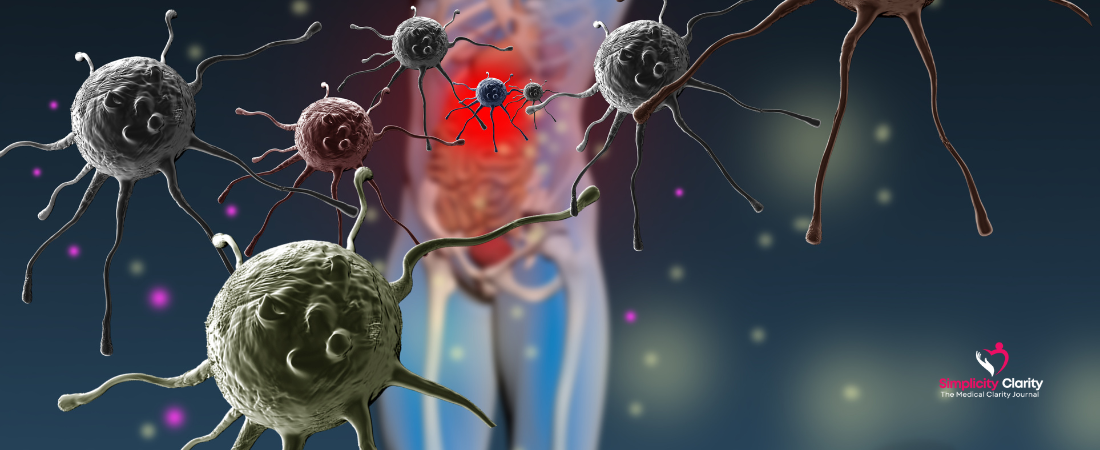 Can I Live with Autoimmune Disease?