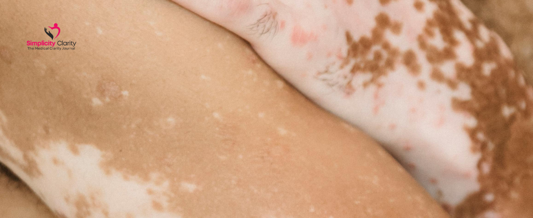 Common STI-Linked Skin Conditions: Early Detection and Clinical Clues